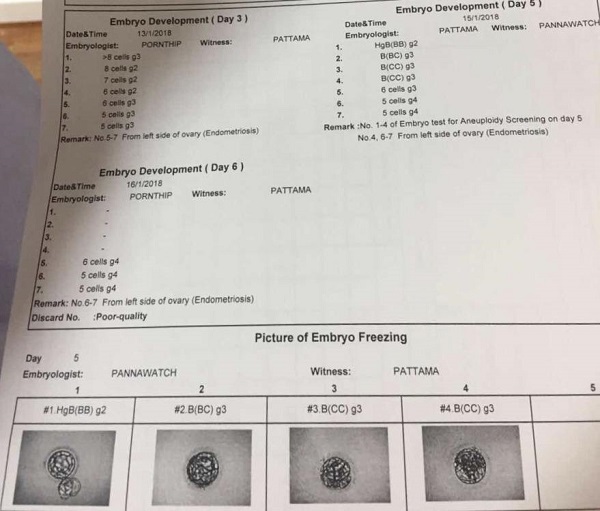 来自小姐姐泰国生子的分享！泰国试管婴儿真经历—医羽自助