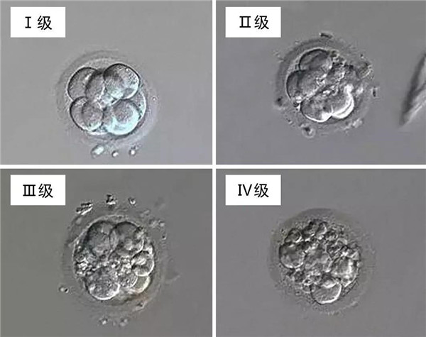 移植了最优质的胚胎，为什么还是失败了？