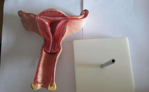 子宫内膜增生是个啥？影响试管婴儿怀孕吗？