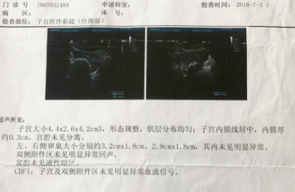 多囊卵巢综合征到底能不能怀孕？我来告诉你