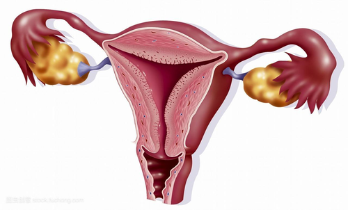 你对子宫腺肌症这生育的克星了解有多少？怎么治疗子宫腺肌症？