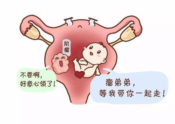 刘畊宏妻子因为9颗子宫肌瘤生三胎时大出血，切除子宫，鬼门关走一遭太可怕了...