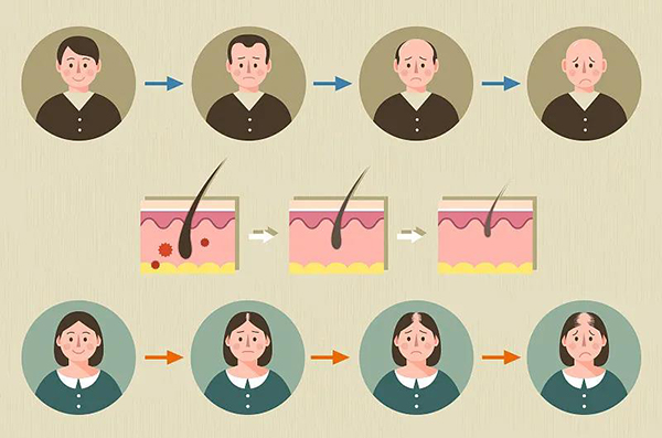 科学新证据：干细胞可以让秃顶的人头发再生