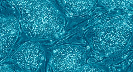 医羽：脐带间充质干细胞治疗卵巢早衰的研究进展