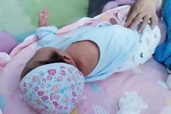 揪心！孕检正常的新生儿出生后却没有右臂