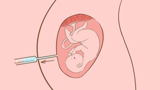 有且只有一个嵌合体胚胎到底该不该移植？有没有风险？